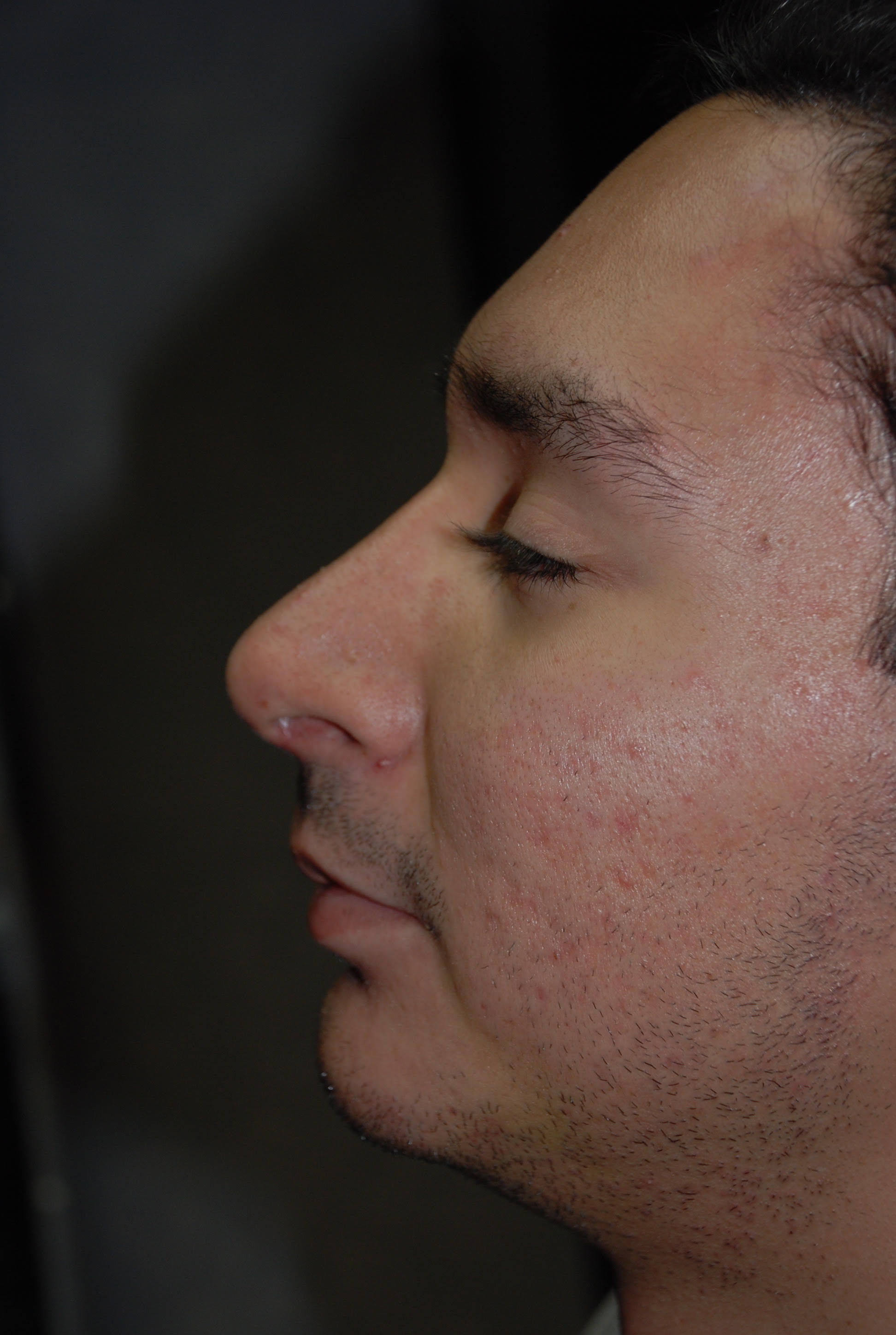 Correspondence Album Cover