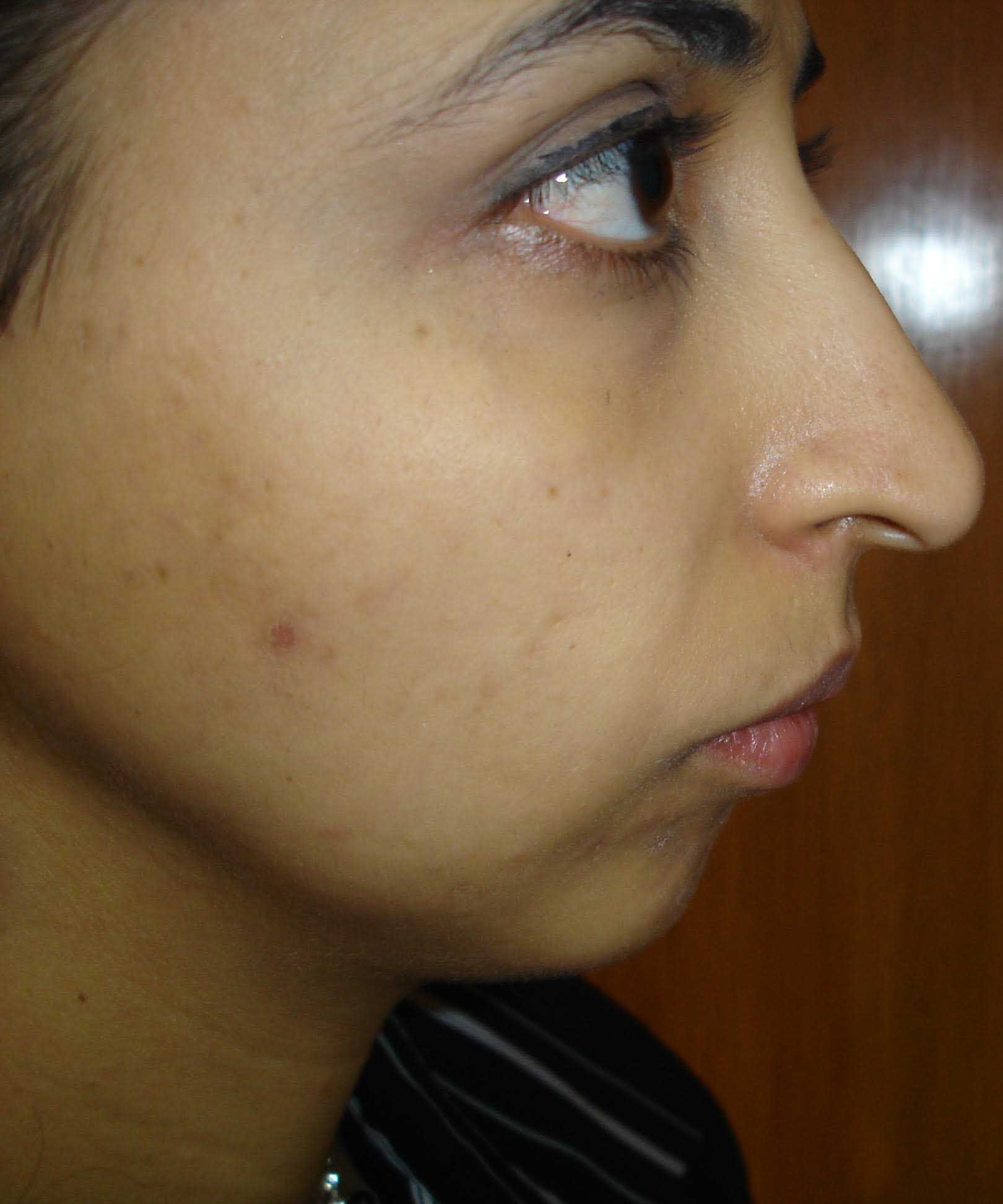 Correspondence Album Cover