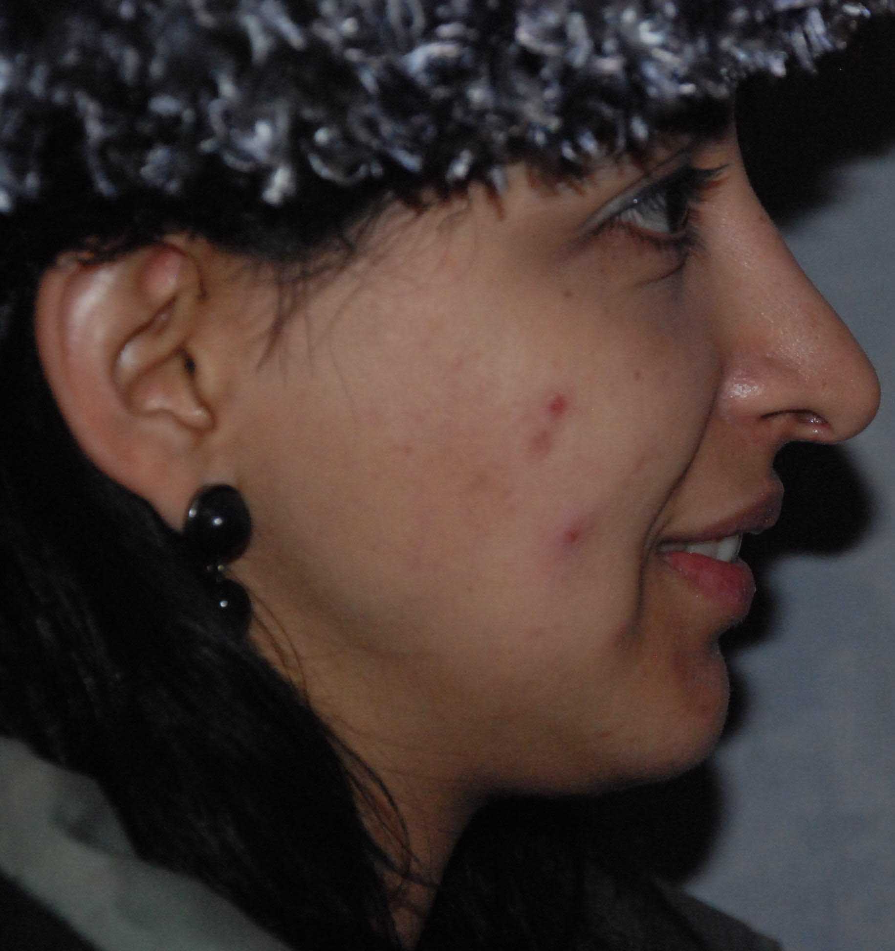 Correspondence Album Cover